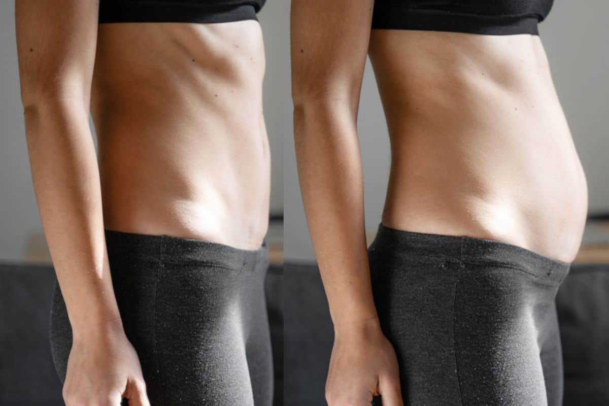 How long does diastasis recti take to improve Shirley?