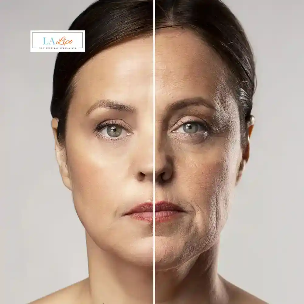 How Can You Tell If Non-Surgical Skin Tightening Is Right for You Shirley?
