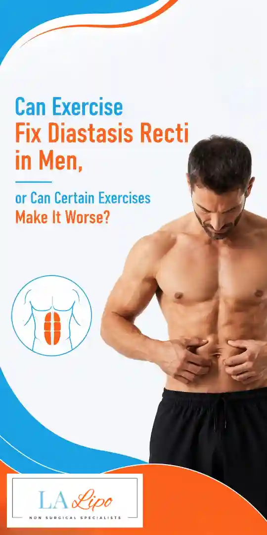 Can Exercise Fix Diastasis Recti in Men, or Can Certain Exercises Make It Worse Shirley?