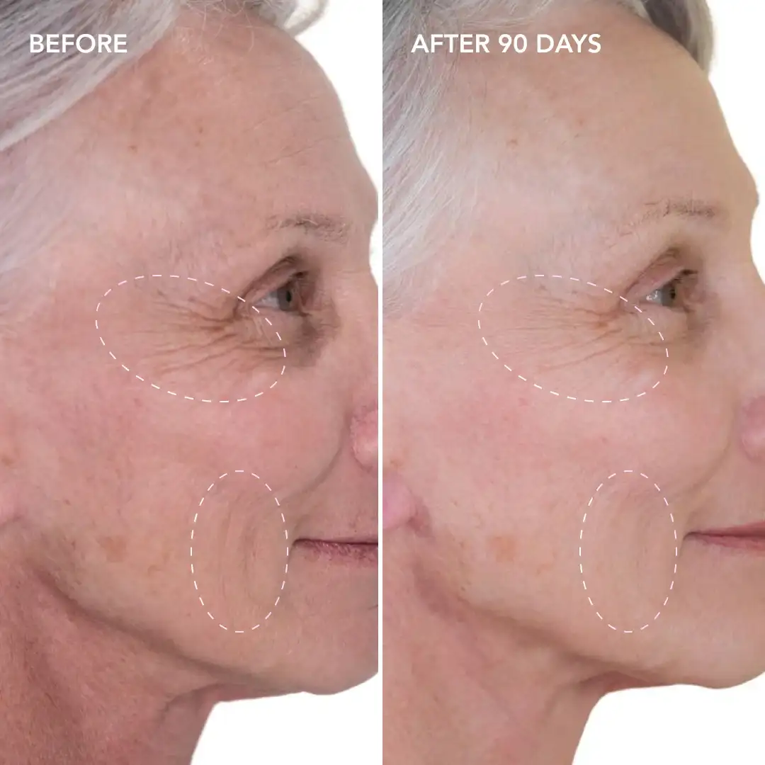 When will you see results Shirley